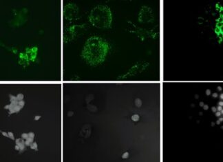 Le nanoplastiche guastano anche il microambiente osseo
