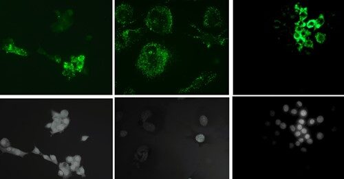 Le nanoplastiche guastano anche il microambiente osseo