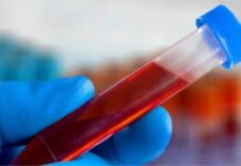 Albumina, la spia del sangue che predice il rischio di cancro e infarto negli anziani Nella ricerca sono state coinvolte circa 18.000 persone delle quali 3.299 di età pari o superiore ai 65 anni.