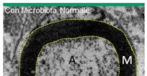Dimostrata l’esistenza di un asse intestino – sistema nervoso periferico