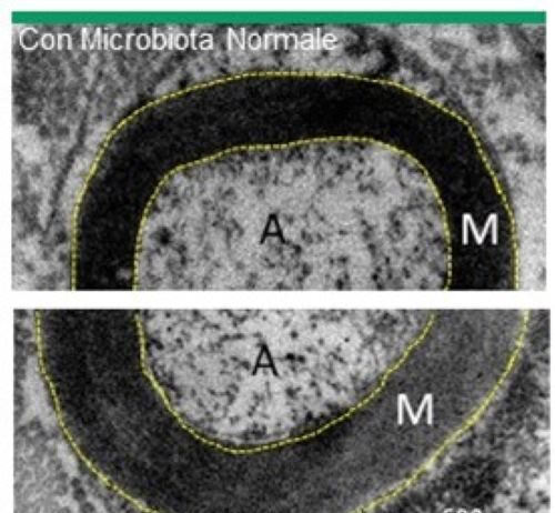 Dimostrata l’esistenza di un asse intestino – sistema nervoso periferico