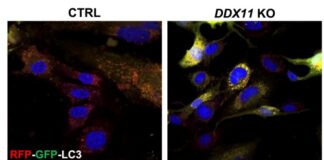 La proteina che pulisce le cellule apre nuove speranze nelle malattie neurodegenerative