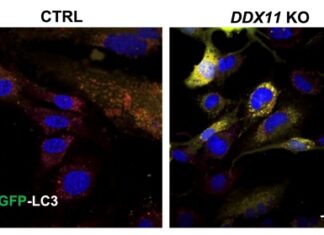 La proteina che pulisce le cellule apre nuove speranze nelle malattie neurodegenerative