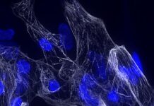 Scoperto un nuovo gene cruciale per la salute del cuore