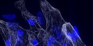Scoperto un nuovo gene cruciale per la salute del cuore
