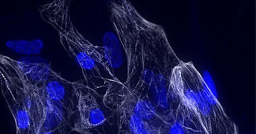 Scoperto un nuovo gene cruciale per la salute del cuore