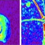 Scoperte le differenze tra astrociti sani e malati: sarà possibile prevedere le malattie neurologiche