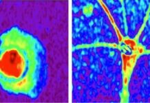 Scoperte le differenze tra astrociti sani e malati: sarà possibile prevedere le malattie neurologiche
