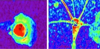 Scoperte le differenze tra astrociti sani e malati: sarà possibile prevedere le malattie neurologiche