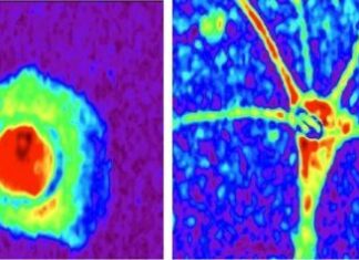 Scoperte le differenze tra astrociti sani e malati: sarà possibile prevedere le malattie neurologiche